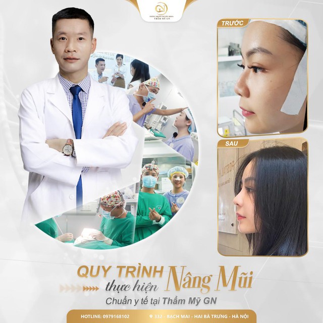 Nên nâng mũi bằng phương pháp nào để đem lại kết quả đẹp, hài hòa, an toàn bền lâu? - Ảnh 4.