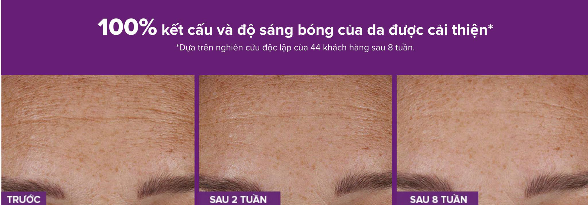 Tiết lộ bí kíp mờ nếp nhăn từ Retinal - Ảnh 3.