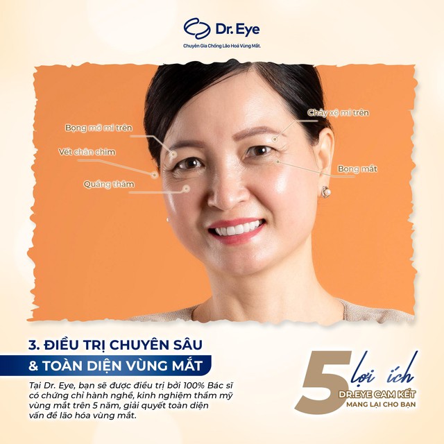 5 lý do phụ nữ trung niên chọn Dr. Eye chống lão hóa vùng mắt - Ảnh 1.