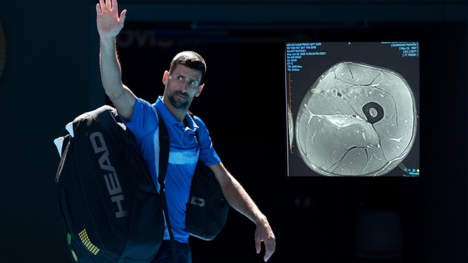 Phim chụp MRI vết rách cơ đùi của Djokovic. Ảnh: Reuters