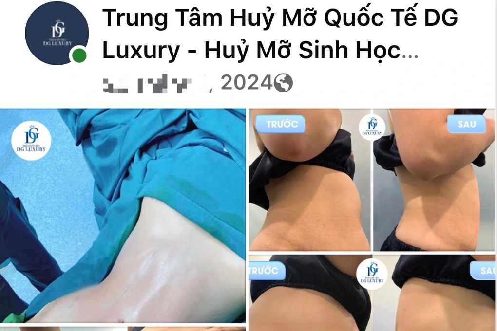 Đóng 153 triệu đồng để nâng ngực ở cơ sở gội đầu - 1