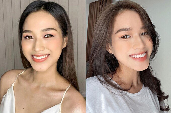 Trước khi tham dự Miss World 2021, Đỗ Thị Hà cải thiện nhược điểm hàm răng hơi vểnh và ngắn bằng cách niềng răng. Người đẹp sử dụng phương pháp niềng trong suốt bằng máng invisalign trong khoảng 5 tháng, nhờ vậy nhan sắc và nụ cười càng hoàn thiện.