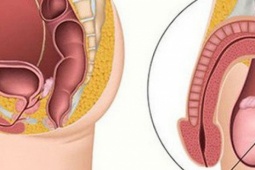 Bé trai 11 tuổi đã mắc ung thư tinh hoàn, chuyên gia cảnh báo dấu hiệu phát hiện sớm bệnh