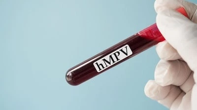 biet-gi-ve-hmpv-virus-dang-lay-o-trung-quoc (1).jpg