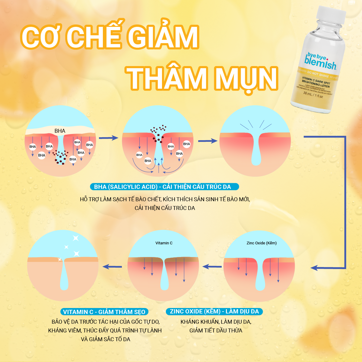 5 sản phẩm giảm mụn, mờ thâm cực đỉnh ai dùng cũng mê- Ảnh 2.