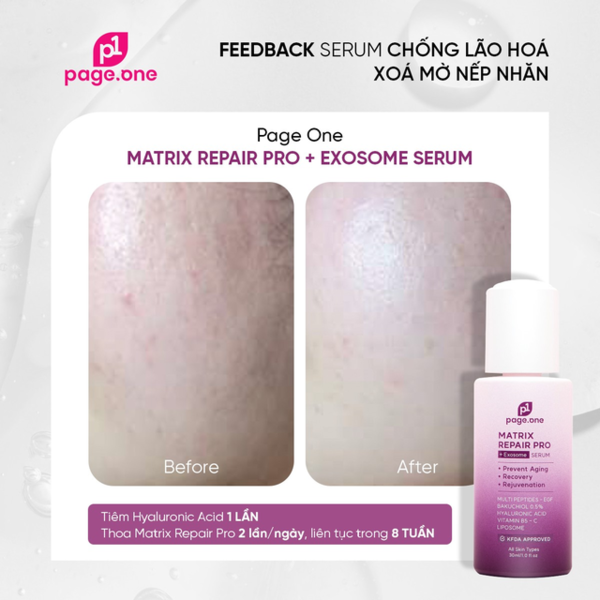 Đánh giá về serum chống lão hóa Page One Matrix Repair Pro + Exosome có tốt không? - Ảnh 3.