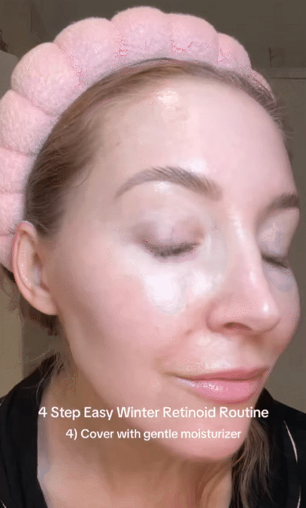 Hóa ra đây là cách dùng retinol "chống già" hiệu quả nhất 10 1758303213 703 Hoa ra day la cach dung retinol chong gia hieu