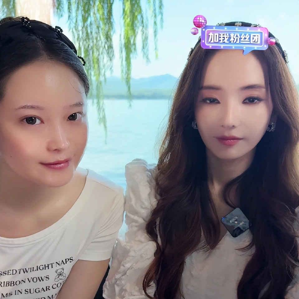 Mỹ nhân đẹp nhất Vườn Sao Băng làm sao thế này: Mặt mũi đơ như tượng, mắt lờ đờ, miệng cũng không mở nổi! - Ảnh 3.