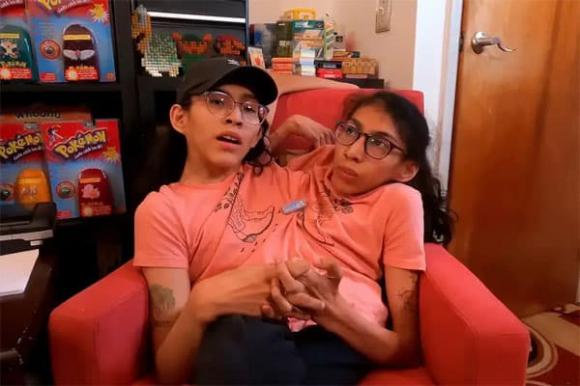 song-sinh2-ngoisaovn-w600-h400 1 chị em, song sinh, kết hôn