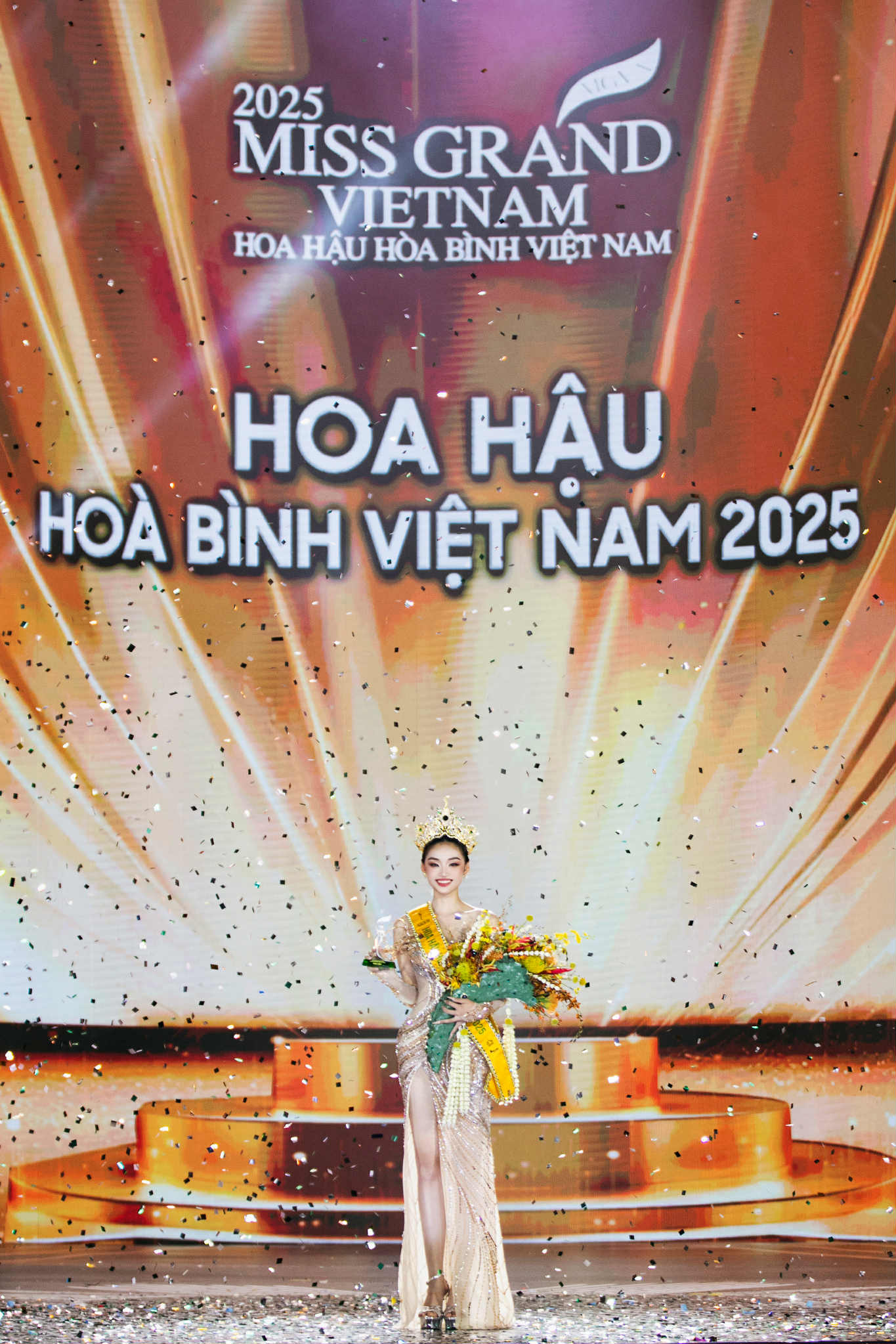 Hoa hậu Yến Nhi chấp nhận phẫu thuật thẩm mỹ - Ảnh 5.