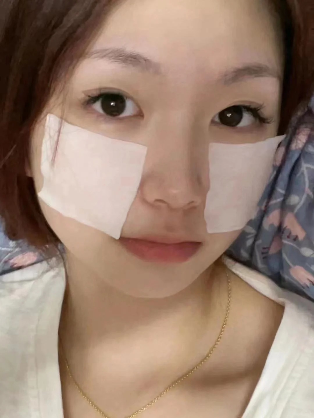 Skincare tối giản dành cho người mới làm thẩm mỹ vùng mặt - Ảnh 3.