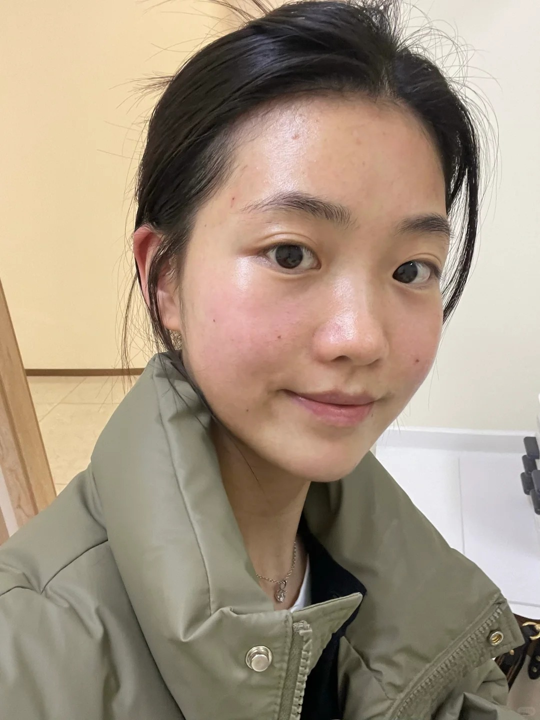 Skincare tối giản dành cho người mới làm thẩm mỹ vùng mặt - Ảnh 4.