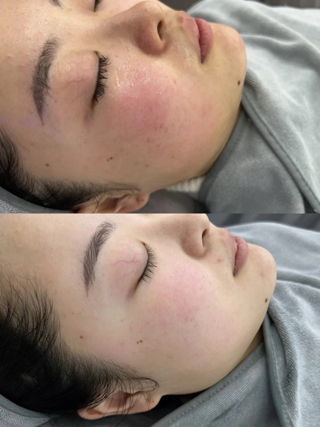 Skincare tối giản dành cho người mới làm thẩm mỹ vùng mặt - Ảnh 5.