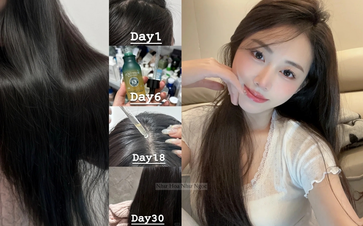 5 lọ "serum cho tóc" giúp tóc mọc chắc khỏe, dày mượt từ chân - Ảnh 1. 5 lọ "serum cho tóc" giúp tóc mọc chắc khỏe, dày mượt từ chân - Ảnh 1.