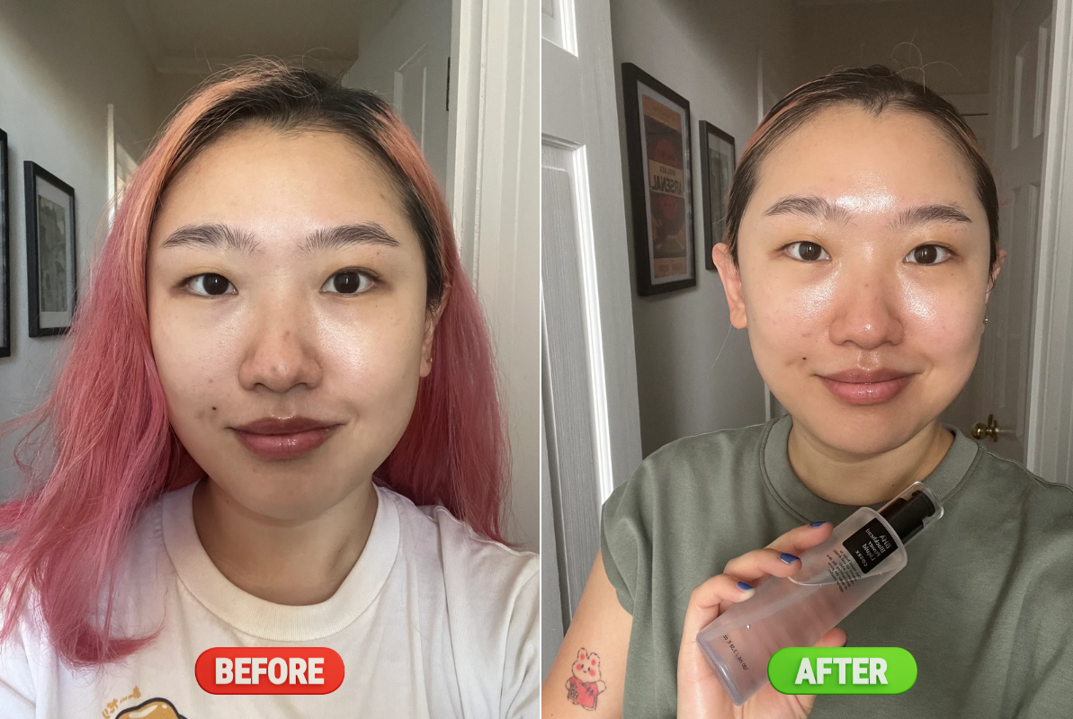 5 toner BHA: Hack da từ sần sùi, khô xỉn thành căng mướt, biến lỗ chân lông rộng ngoác thành nhỏ mịn- Ảnh 1. 5 toner BHA: Hack da từ sần sùi, khô xỉn thành căng mướt, biến lỗ chân lông rộng ngoác thành nhỏ mịn- Ảnh 1.