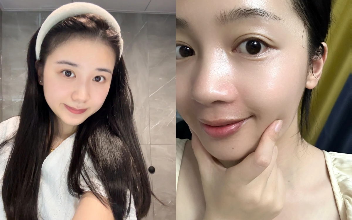  6 lọ acid toner là “khắc tinh” của da dầu mụn và lỗ chân lông to - Ảnh 1.