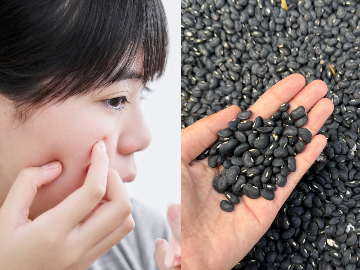 Đây cũng là thực phẩm có lợi cho làn da.