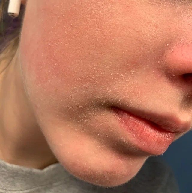 Chia sẻ thật: Tôi giữ da căng mịn ở tuổi U40 nhờ 1 bí quyết nhỏ vào mùa thu- Ảnh 1.