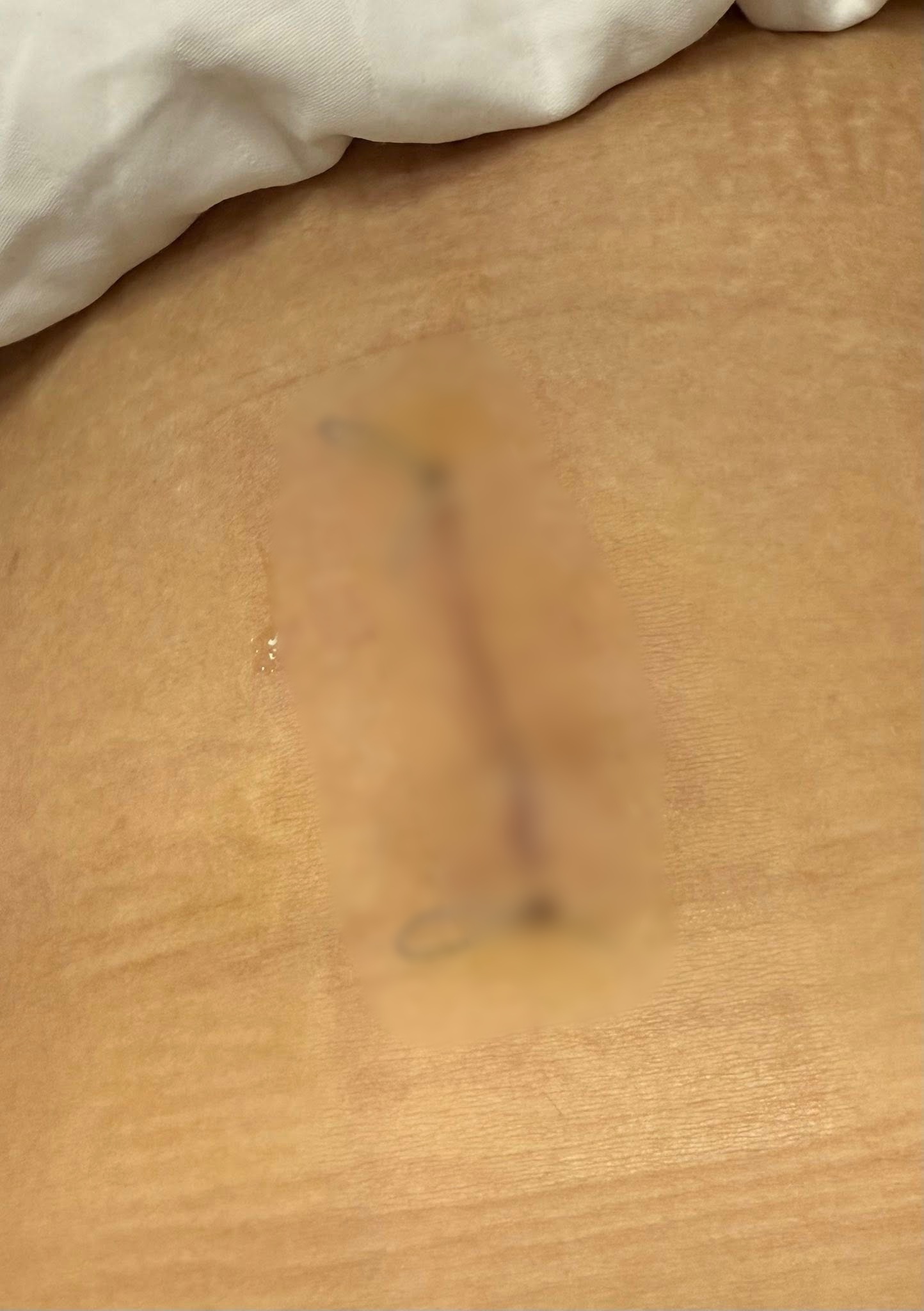 Vụ cô gái nuốt kim băng đang mở khi ăn ốc: Chính chủ nói rõ lý do nuốt vật nhọn mà không hay biết- Ảnh 5. Vụ cô gái nuốt kim băng đang mở khi ăn ốc: Chính chủ nói rõ lý do nuốt vật nhọn mà không hay biết- Ảnh 5.