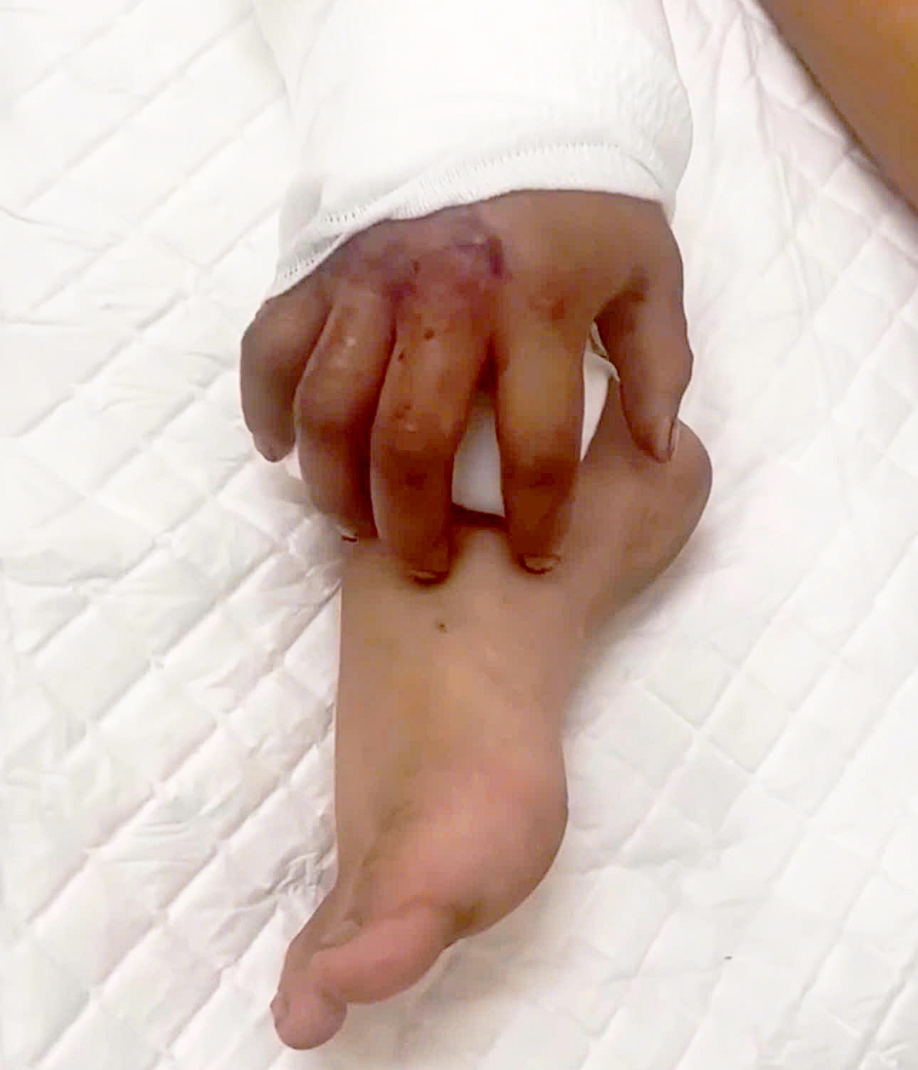 Độc đáo kỹ thuật 'nuôi chi' tái tạo cơ thể 1 Độc đáo kỹ thuật 'nuôi chi' tái tạo cơ thể - Ảnh 2.