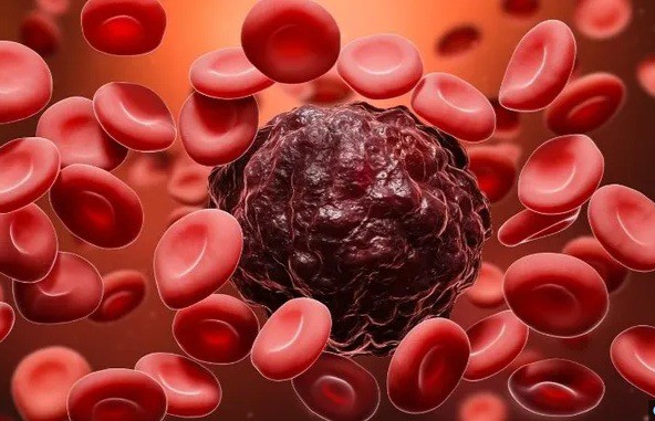 Nam diễn viên 34 tuổi đang khỏe mạnh bất ngờ tiết lộ mắc ung thư máu: Tâm sự đầy xúc động! 3 Ảnh minh họa