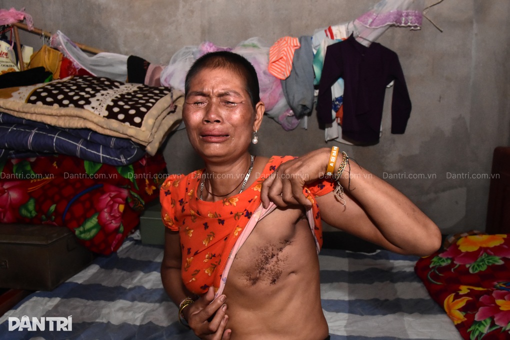 Người phụ nữ góa bụa mắc 2 bệnh nan y mong được cứu giúp - 1