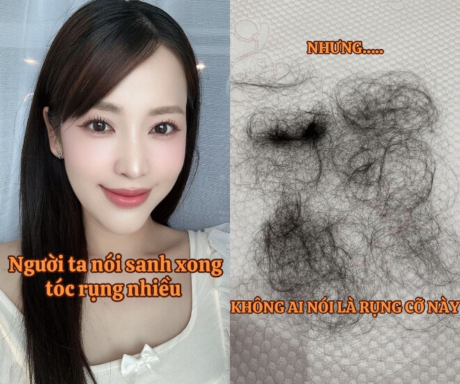 Puka tóc mọc lởm chởm sau khi sinh con đầu lòng, U40 đẻ xong vẫn đẹp rạng rỡ bảo sao Gin Tuấn Kiệt cưng chiều 1 Puka rụng nhiều tóc sau khi sinh con đầu lòng.