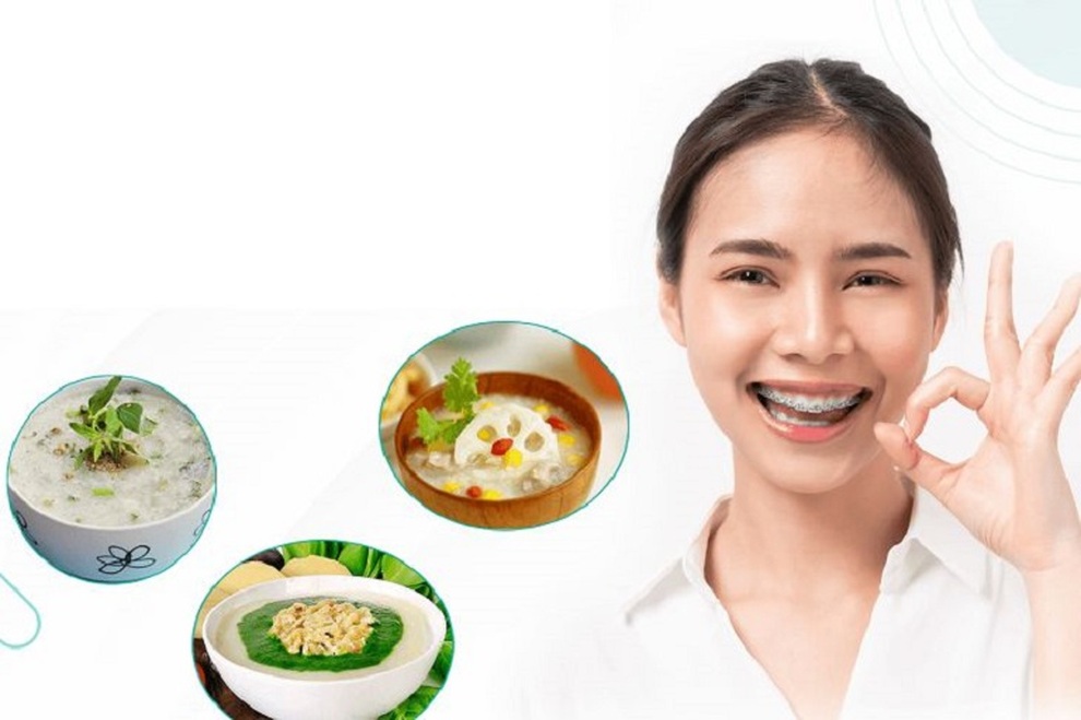 Sai lầm khi niềng răng nhiều người Việt mắc phải - 2