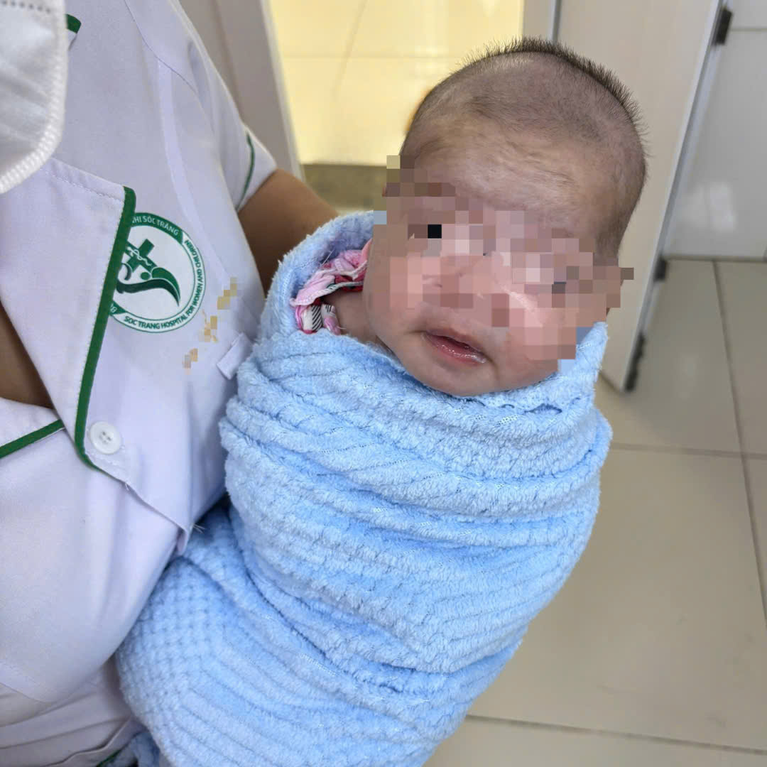 Trẻ sơ sinh 8 ngày tuổi bị uốn ván nặng 1 Uốn ván - Ảnh 1.