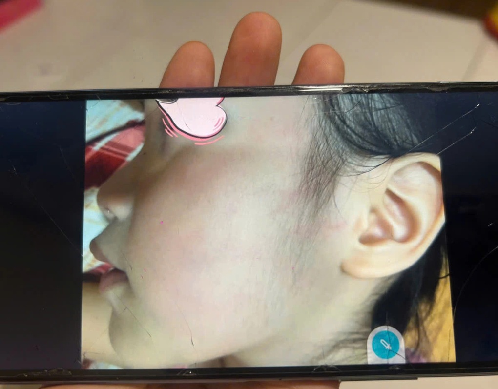 Vụ con bị tát, phụ huynh bức xúc đăng lên mạng: Giải trình của cô giáo - 1