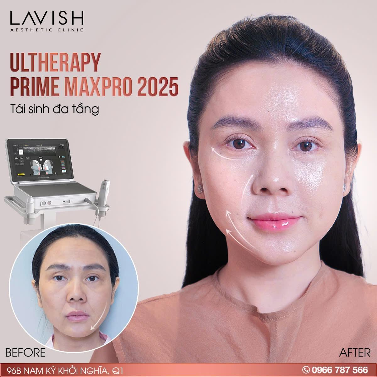 Vén màn bí mật về cách duy trì nhan sắc trẻ trung, chống lão hóa của giới thượng lưu Việt- Ảnh 3. Vén màn bí mật về cách duy trì nhan sắc trẻ trung, chống lão hóa của giới thượng lưu Việt- Ảnh 3.