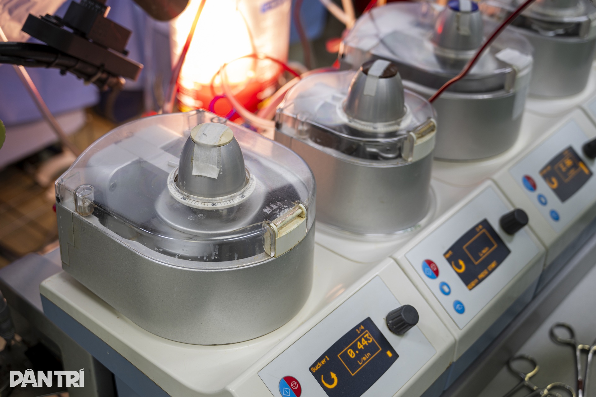 Hồi hộp xem bác sĩ đeo kính 3D xe chỉ, luồn kim cứu trái tim lỗi nhịp - 4 Hồi hộp xem bác sĩ đeo kính 3D xe chỉ, luồn kim cứu trái tim lỗi nhịp - 4