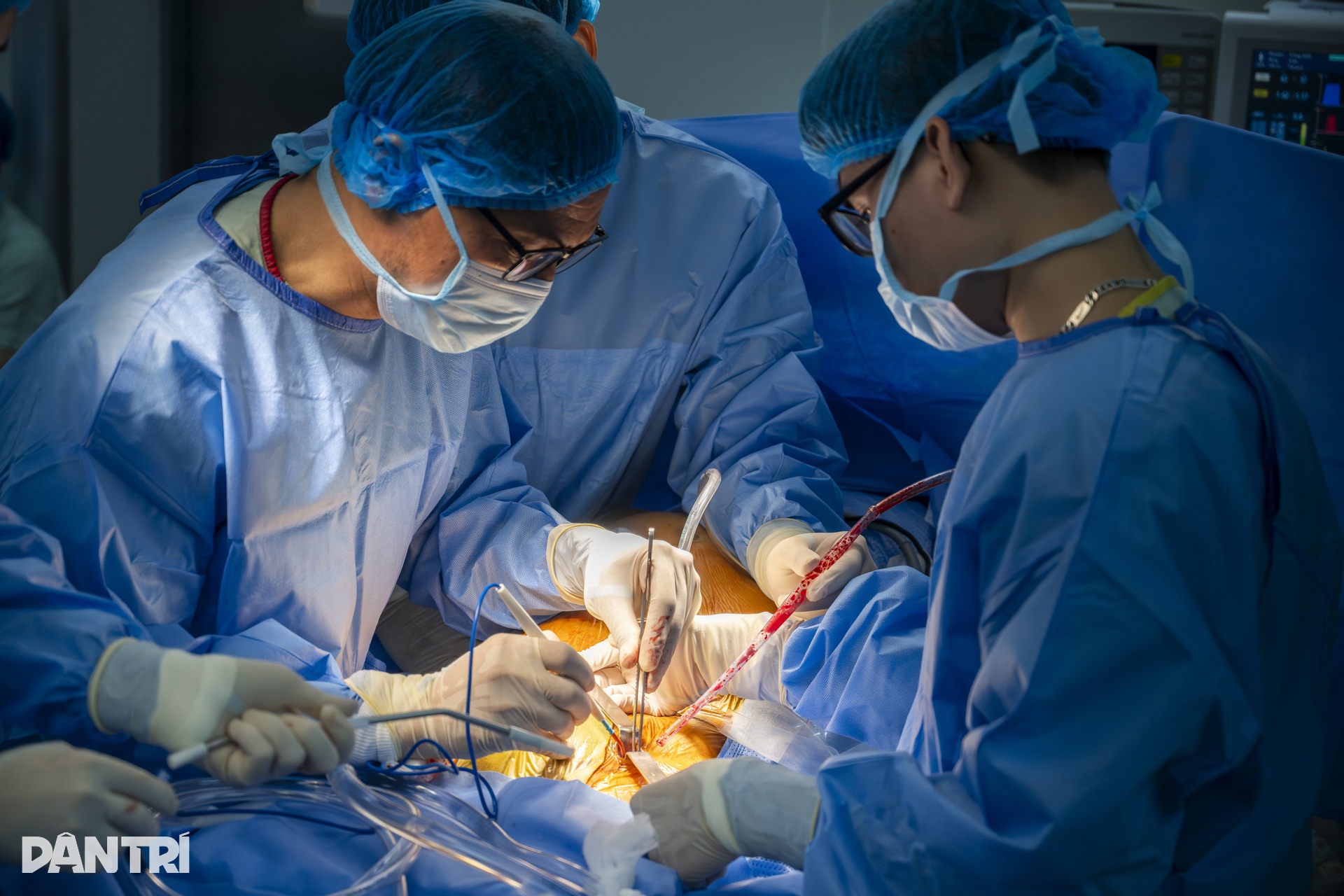 Hồi hộp xem bác sĩ đeo kính 3D xe chỉ, luồn kim cứu trái tim lỗi nhịp - 5 Hồi hộp xem bác sĩ đeo kính 3D xe chỉ, luồn kim cứu trái tim lỗi nhịp - 5