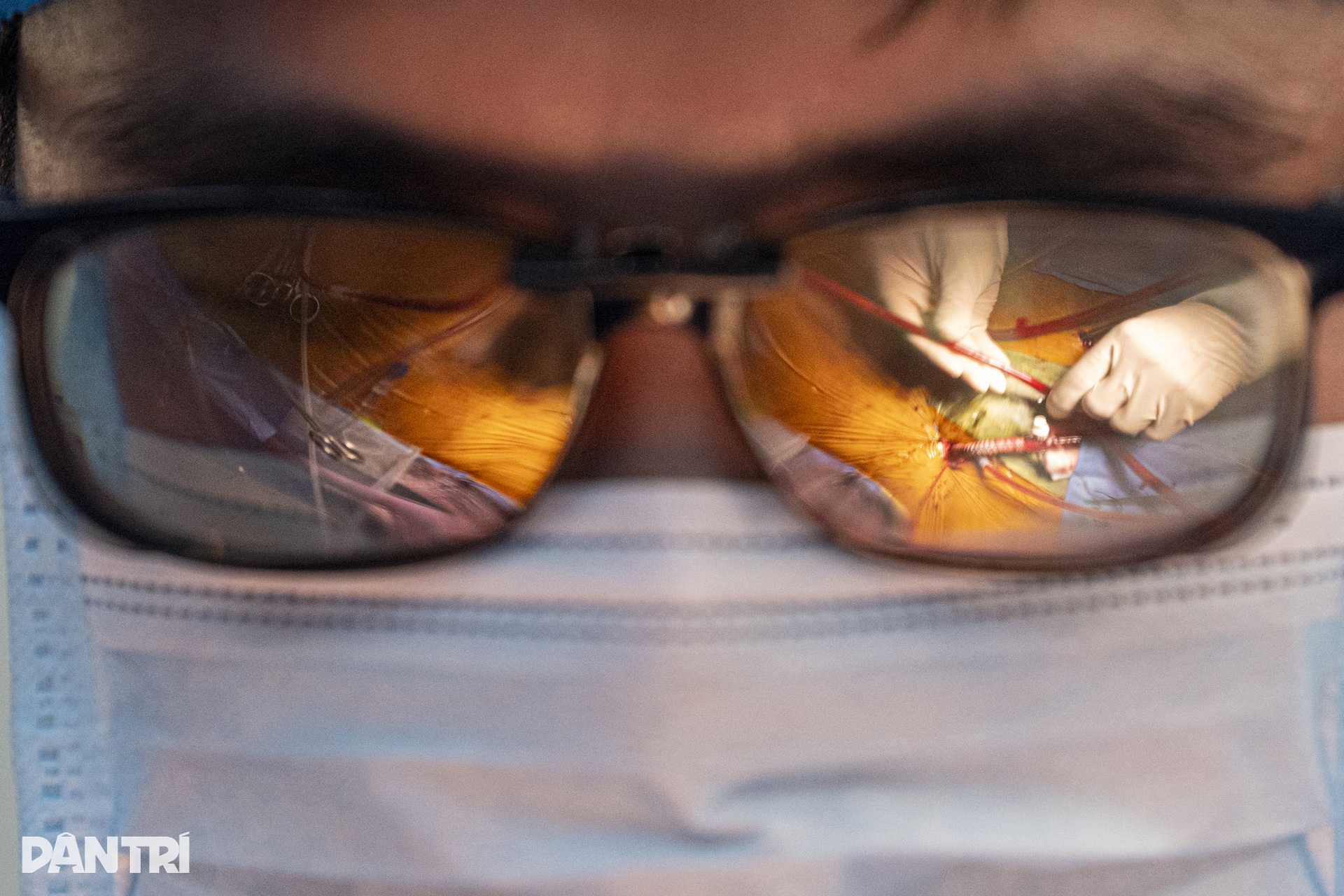 Hồi hộp xem bác sĩ đeo kính 3D xe chỉ, luồn kim cứu trái tim lỗi nhịp - 9 Hồi hộp xem bác sĩ đeo kính 3D xe chỉ, luồn kim cứu trái tim lỗi nhịp - 9