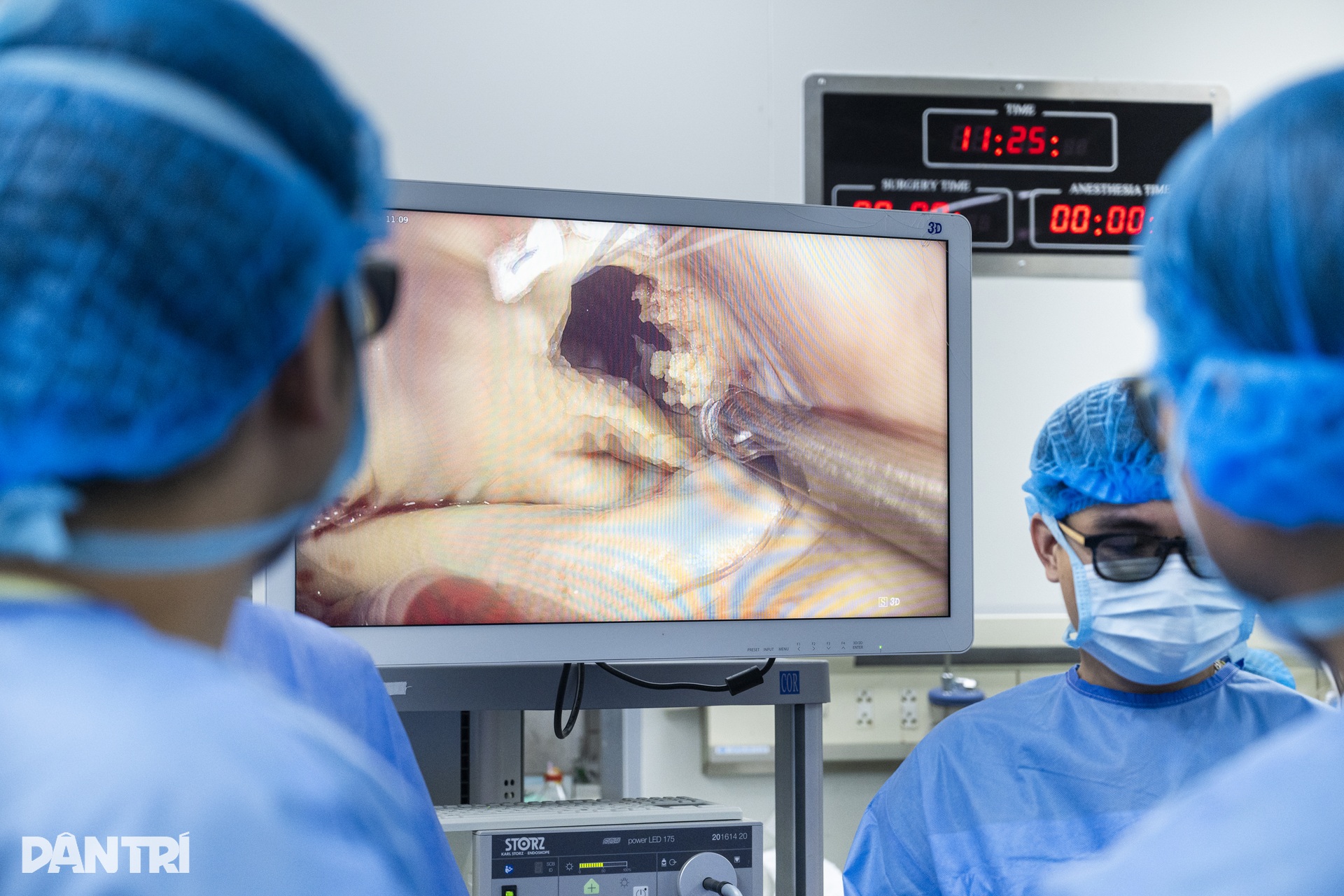 Hồi hộp xem bác sĩ đeo kính 3D xe chỉ, luồn kim cứu trái tim lỗi nhịp - 11 Hồi hộp xem bác sĩ đeo kính 3D xe chỉ, luồn kim cứu trái tim lỗi nhịp - 11