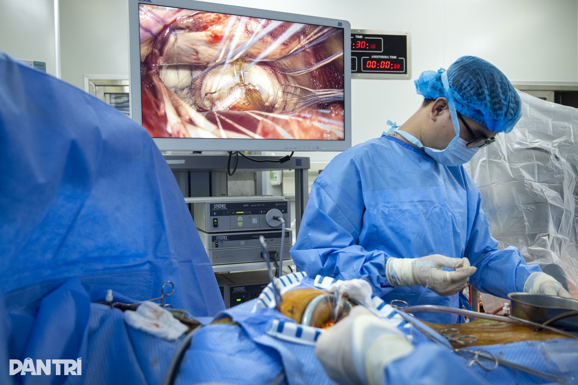 Hồi hộp xem bác sĩ đeo kính 3D xe chỉ, luồn kim cứu trái tim lỗi nhịp - 19 Hồi hộp xem bác sĩ đeo kính 3D xe chỉ, luồn kim cứu trái tim lỗi nhịp - 19