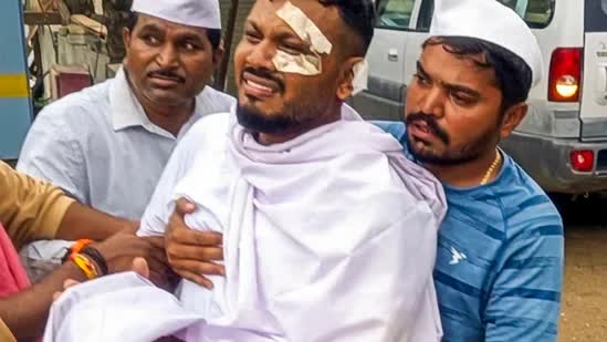 Tình hình hiện tại của người sống sót duy nhất trong thảm kịch máy bay Air India sau 3 tháng- Ảnh 2.