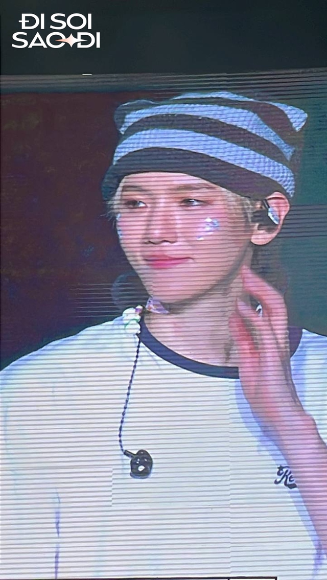 Nam thần Kpop sang Việt Nam vấp chân suýt vồ ếch trên sân khấu, mẩn đỏ dị ứng lan khắp cổ- Ảnh 5.