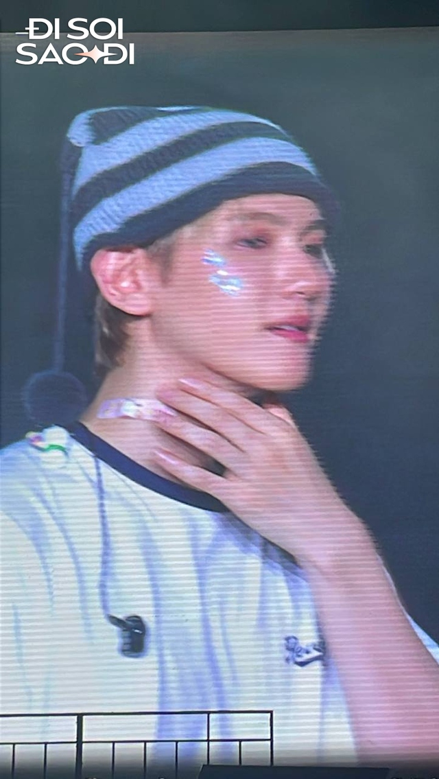 Nam thần Kpop sang Việt Nam vấp chân suýt vồ ếch trên sân khấu, mẩn đỏ dị ứng lan khắp cổ- Ảnh 6.