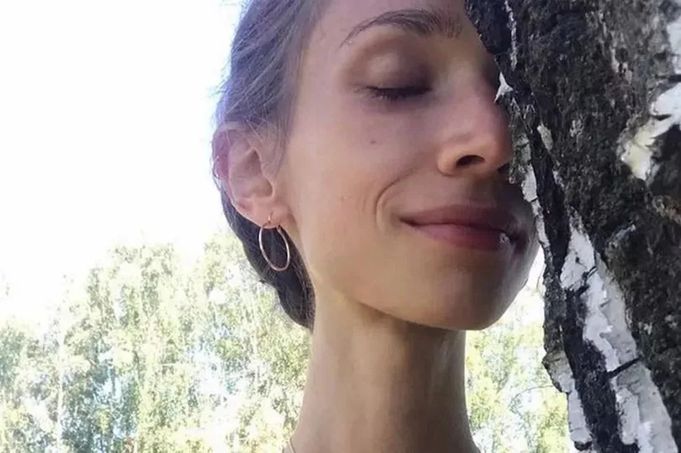 Cô gái bị phát hiện chết đói ở khách sạn: Chỉ ăn trái cây, cơ thể nặng 22kg - 2