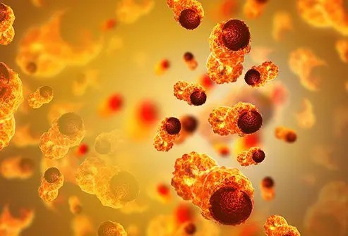 Cơ thể bỗng xuất hiện những dấu hiệu này đừng chủ quan, coi chừng nguy cơ mắc ung thư - 4