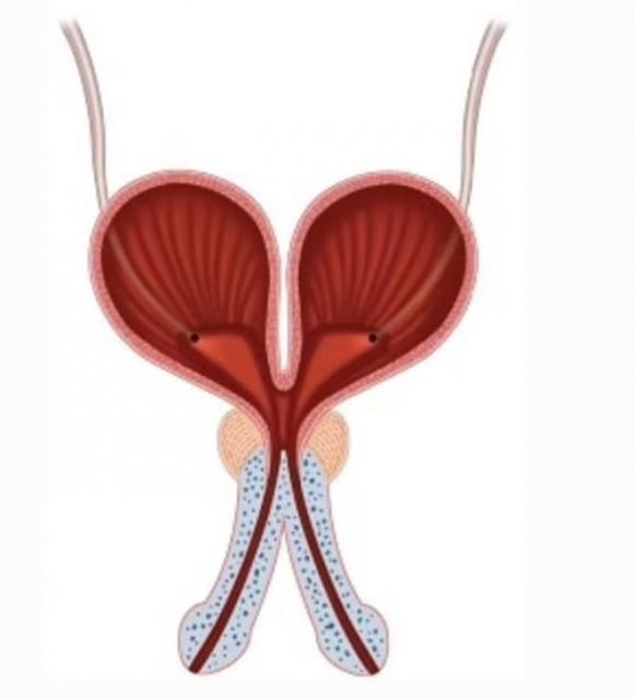 Người đàn ông có 2 