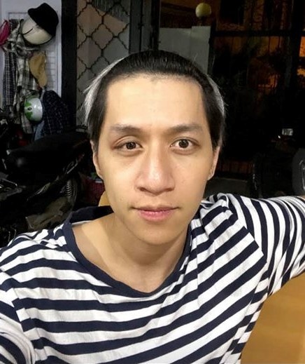 Anh Trai Say Hi bị tai nạn liệt nửa mặt, ám ảnh vì ngoại hình biến dạng- Ảnh 3.