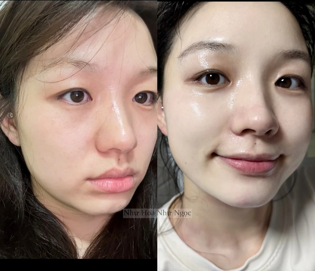 Ngoài 30 tuổi mà da vẫn bóng như gương nhờ 5 lọ "serum bơm nước" đỉnh cao - Ảnh 2.
