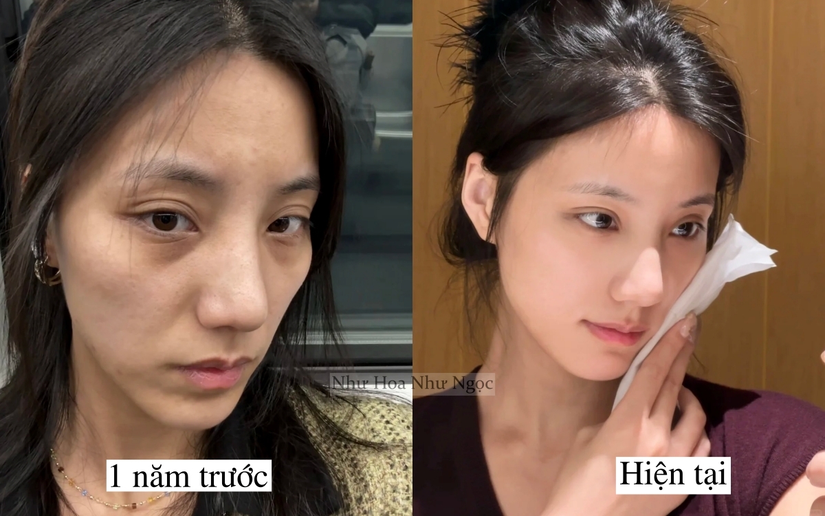 Tôi lấy lại làn da tuổi 20 nhờ 1 năm ngủ sớm, ăn lành và chăm da đúng cách - Ảnh 3.