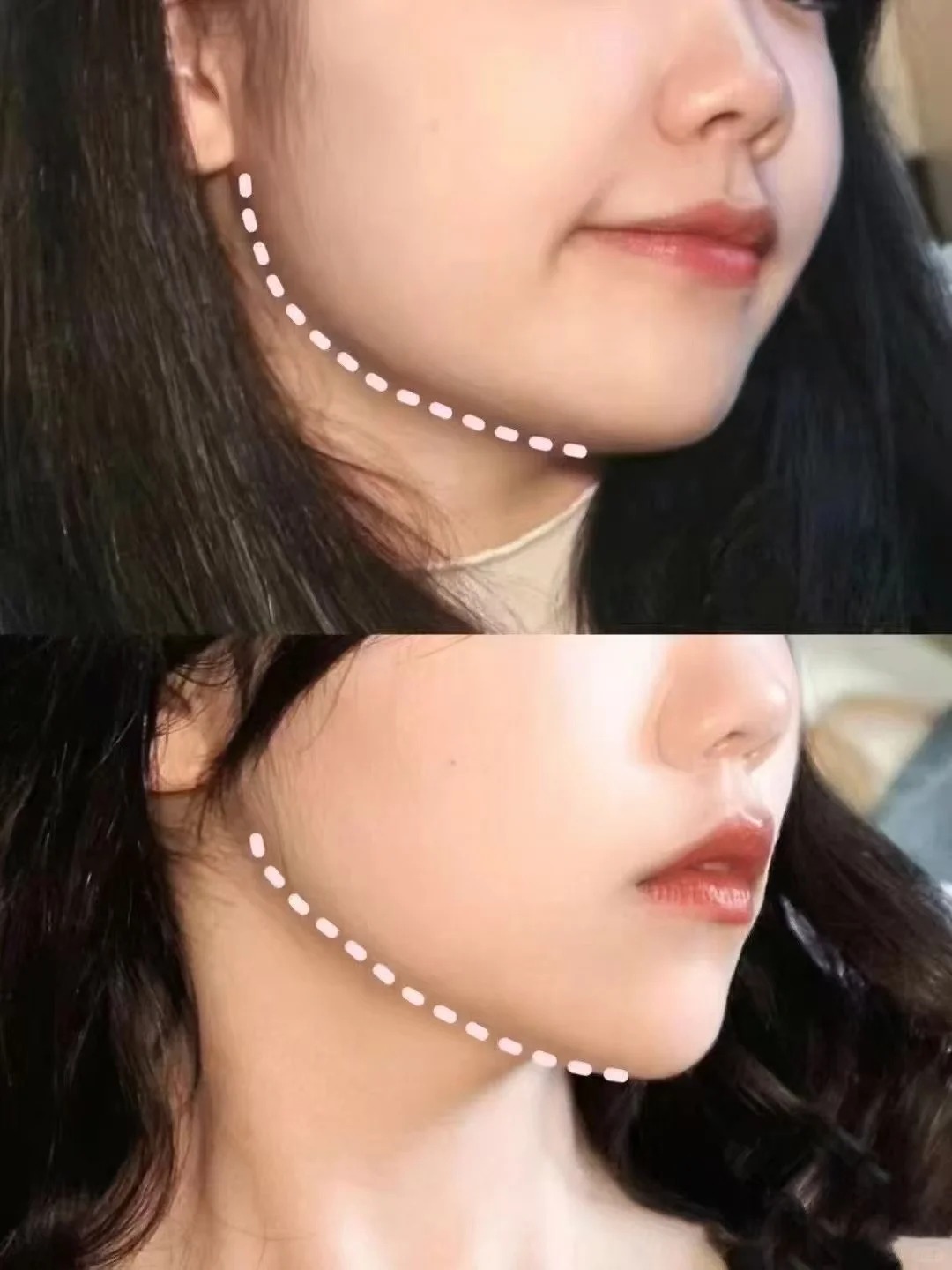 Bí quyết giữ nhan sắc hậu dao kéo: Không chỉ là tiền - Ảnh 2. Bí quyết giữ nhan sắc hậu dao kéo: Không chỉ là tiền - Ảnh 2.