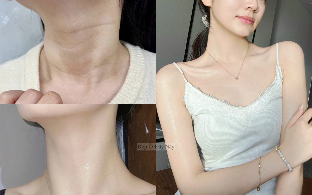 Bí kíp của phụ nữ Trung Quốc: Chỉ 15 phút mỗi ngày để "là phẳng" nếp nhăn vùng cổ - Ảnh 2.