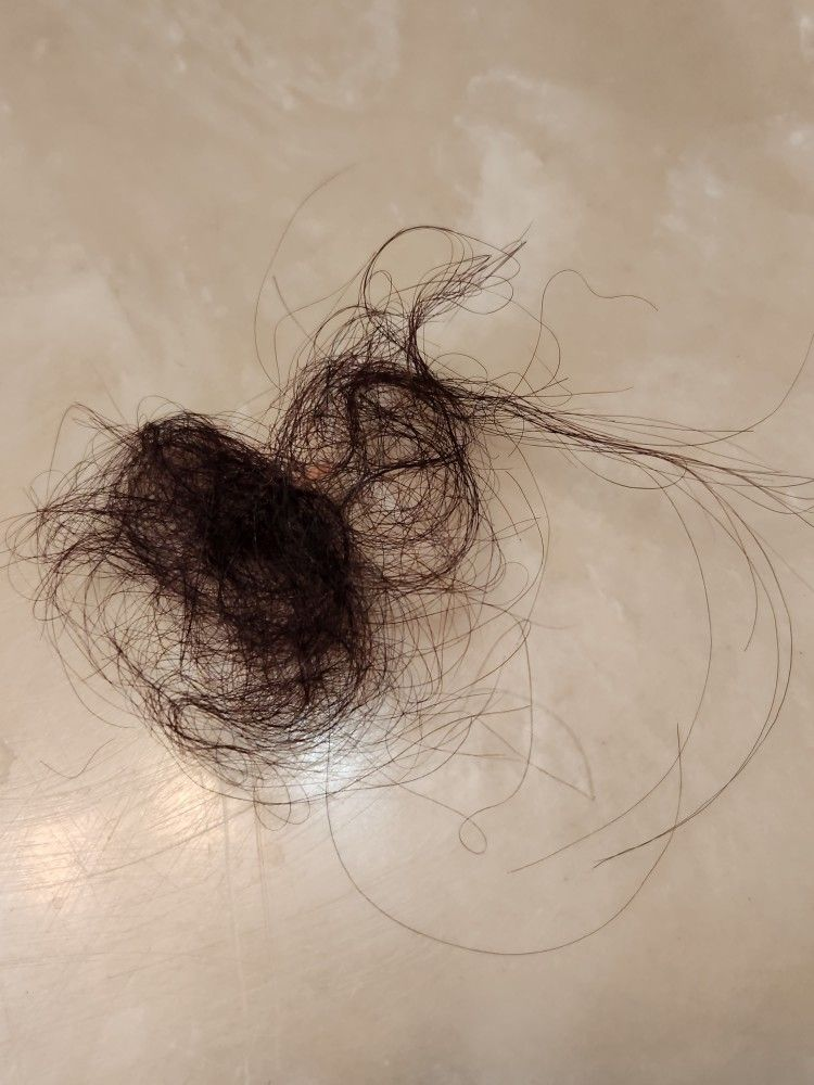 1760973914 921 Toi da phuc hoi mai toc kho xo gay rung