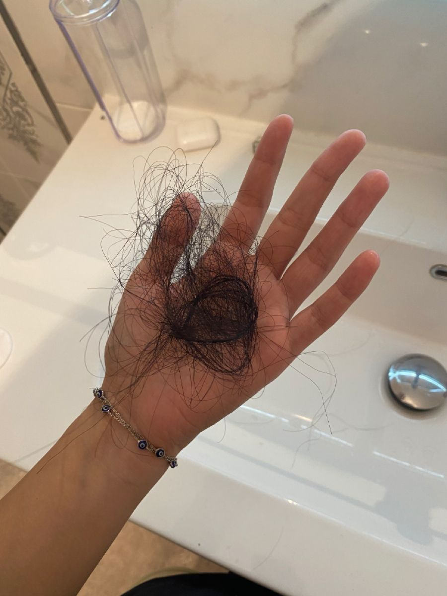 1760973915 203 Toi da phuc hoi mai toc kho xo gay rung