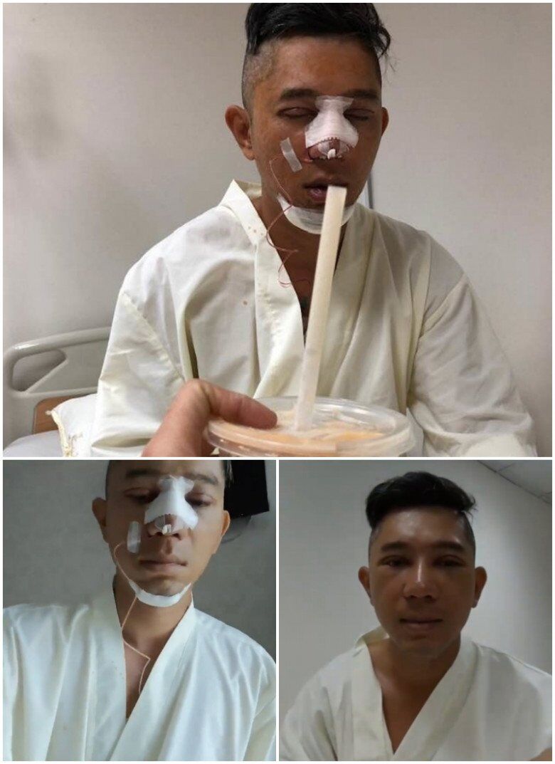 Được biết, Lương Bằng Quang đã thực hiện cắt mí, sửa mũi, làm lại cằm và anh phải chi số tiền khoảng 100 triệu đồng cho ca đại phẫu thuật cùng bạn gái sexy.